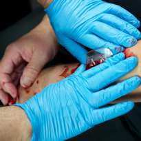 Healthcare worker dressing bloody wound